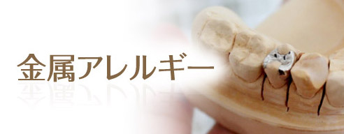 金属アレルギー